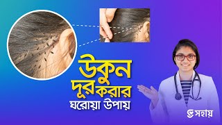 মাত্র ১ দিনেই উকুন দূর করার উপায় - ডা. তাসনিম জারা (চিকিৎসক, ইংল্যান্ড)