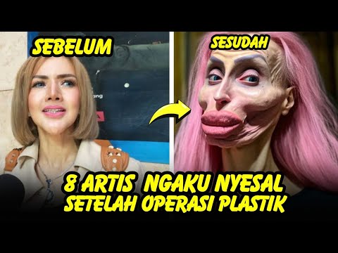 GAGAL CANTIK, 8 artis ini mengaku menyesal setelah Lakukan operasi plastik