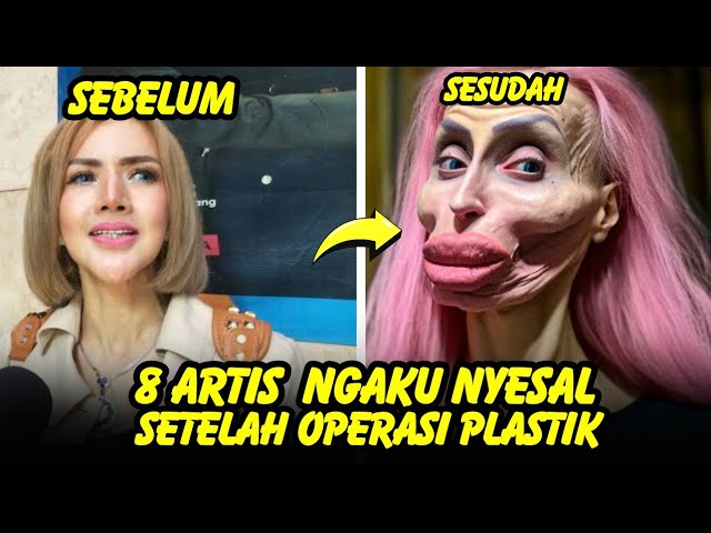 GAGAL CANTIK, 8 artis ini mengaku menyesal setelah Lakukan operasi plastik class=