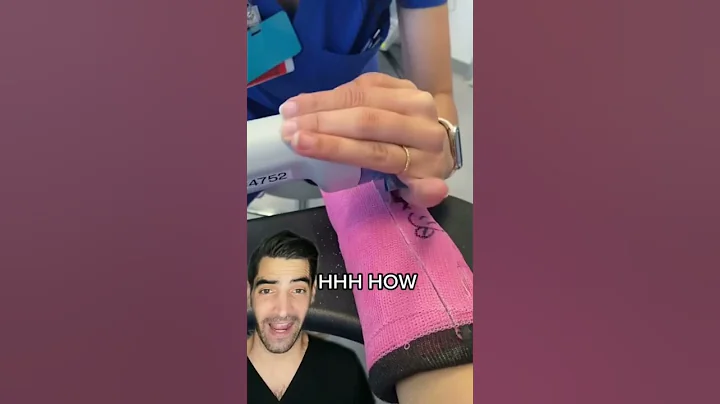 Cast coming off for a wrist break