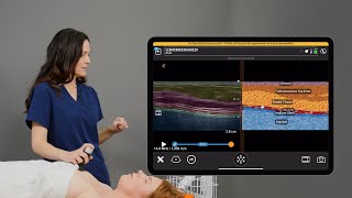 Clarius T-Mode™ for Breast