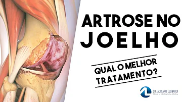 Quanto tempo demora uma recuperação de cirurgia no joelho?
