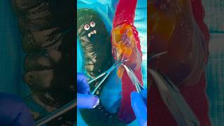 Emergency Giant Gummy Worm Gives Birth