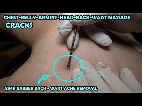 ASMR BARBER BACK ACNE REMOVAL AND MASSAGE 💈 RAZOR BACK SHAVE 💈 CRACKS 💈 DEEP TİSSUE MASSAGE FOR YOU