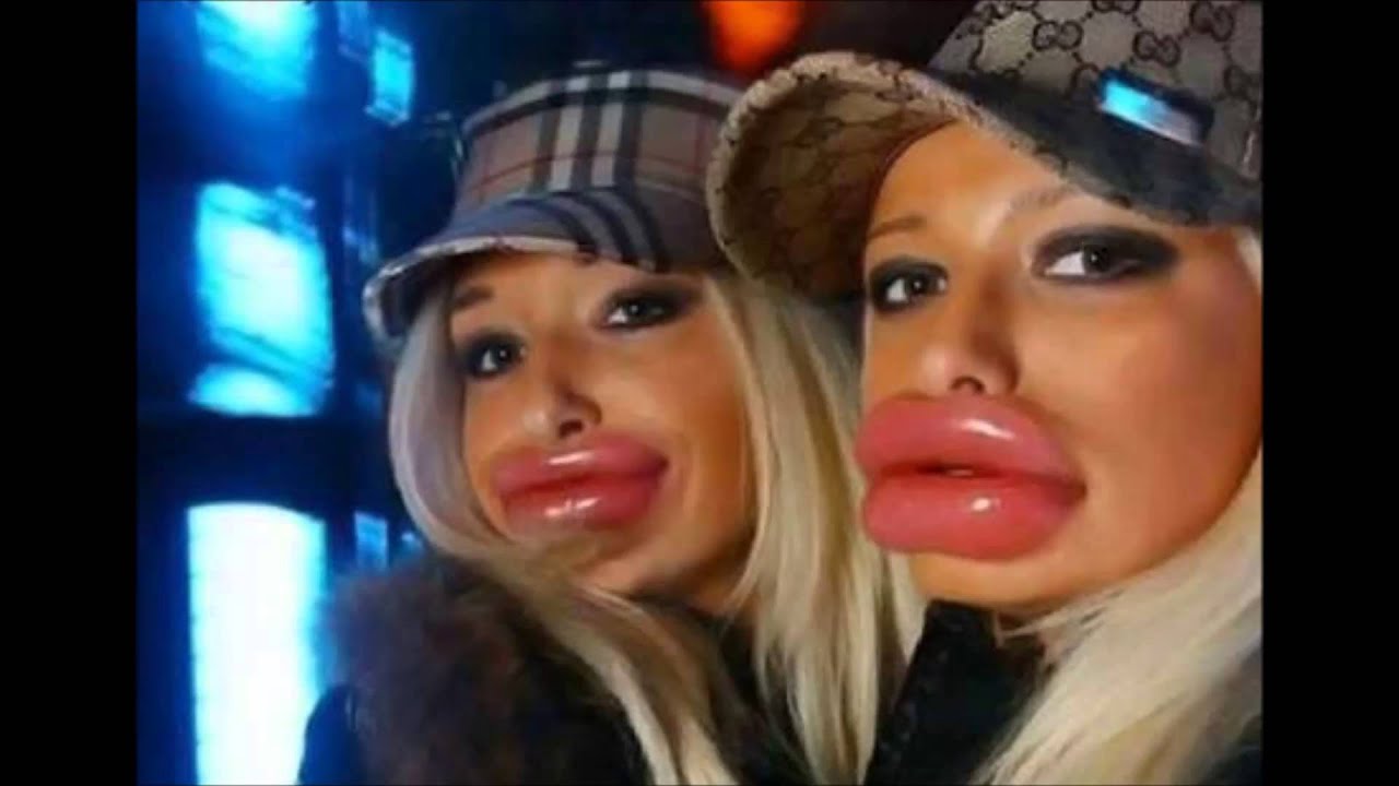 Mutant Lips Is This The New Trend - Youtube-9456