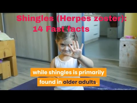 Shingles (herpes zoster): 14 fast facts