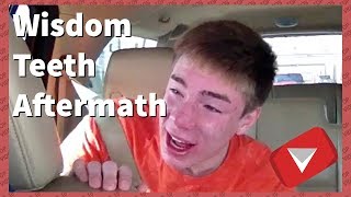 Wisdom Teeth Aftermath Compilation [2017] (TOP 10 VIDEOS)