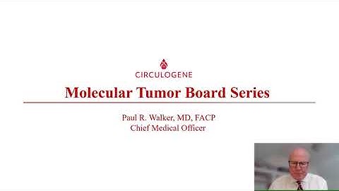 Molecular Tumor Board - Thoracic ARID1A and PD-L1 present