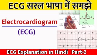 ECG report कैसे देखते हैं I ECG explanation in Hindi I Electrocardiogram