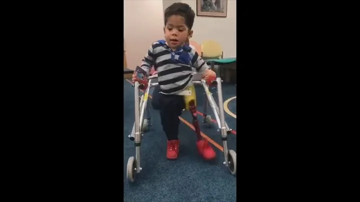 Belleville boy's prosthetic leg stolen