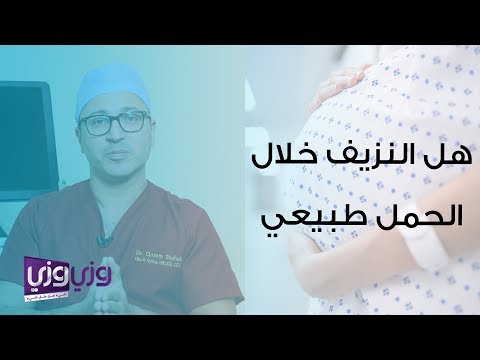 فيديو: هل يمكن أن يكون النزيف علامة على الحمل؟