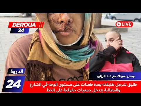 طليق شرمل طليقته بعدة طعنات على مستوى الوجه في الشارع والمطالبة بتدخل جمعيات حقوقية على الخط