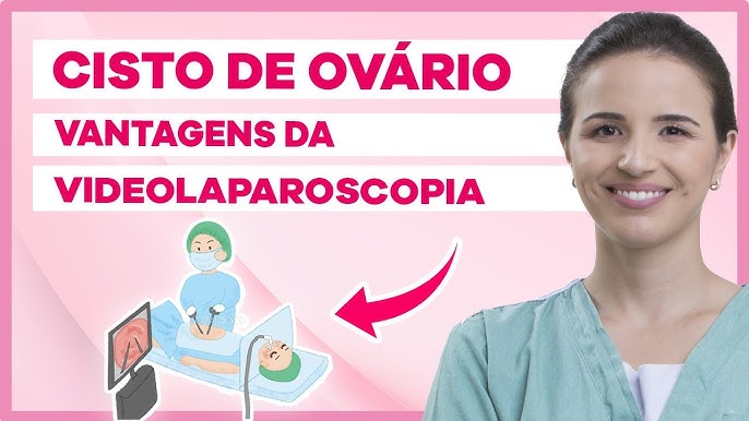 Ooforoplastia por video (cisto dermoide) / Video oophoroplasty (dermoid  cyst) 