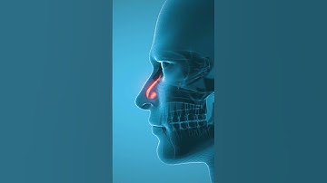 Sinus inflammation 3D animation