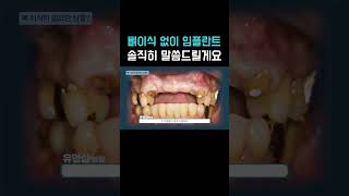 뼈이식 없이 임플란트, 솔직히 말씀드릴게요