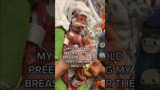 My 27 Week Premature Baby Having My Breast Milk For The First Time...