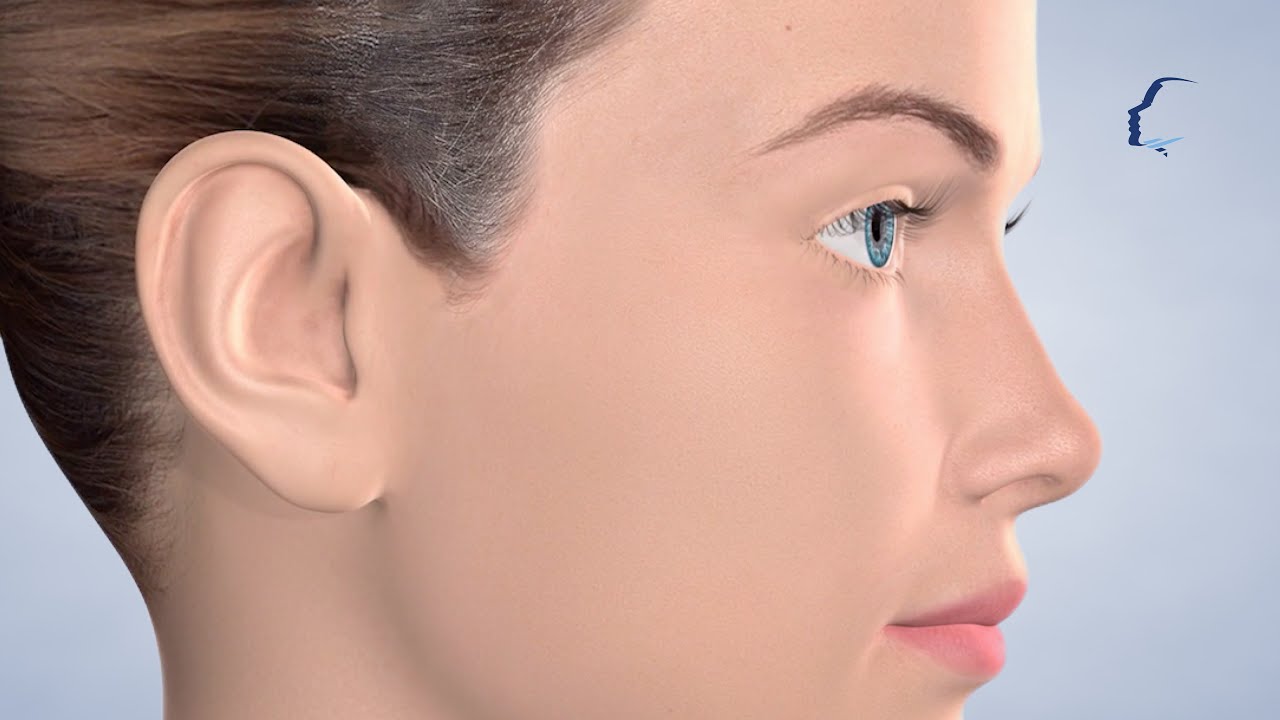 Dermaplaning at Carolinas Center for Cosmetic Surgery YouTube