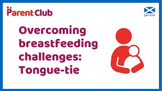 Overcoming breastfeeding challenges: Tongue-tie