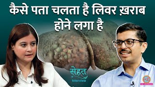 खाने पीने की कौन सी चीज़ें Liver ख़राब होने से बचा लेतीं हैं, जानिए डॉक्टर से | Sehat Interview #3