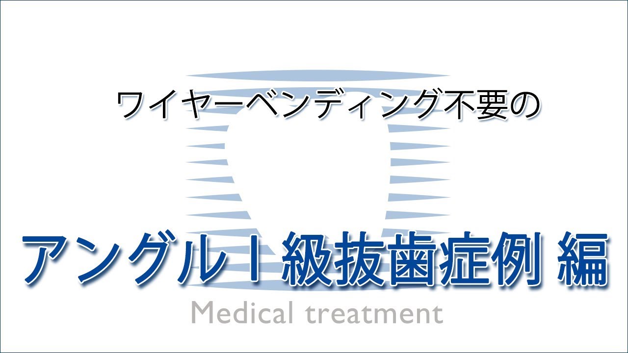 Dr.峰の誰でもできる矯正導入のファーストステップ ワイヤー