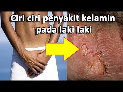 obat-kelamin-keluar-nanah-di-apotik---wa-087736710838