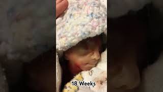 18 Weeks #pregnancyjourney #pregnant #baby #viralshortfeed #pregnancy