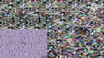 My Shuric Scan Teraparison