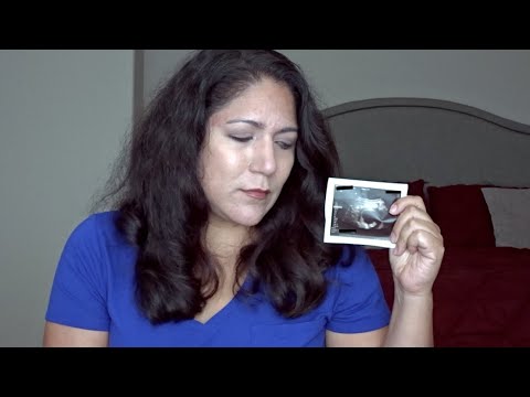 Losing Our Baby