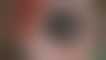 DMEK upside - down trick