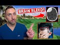 Good Good Luke Kwon&#39;s Brain Injury Explained - Doctor Reacts to Golf Accident