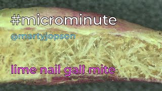 #microminute 37 lime nail gall mite