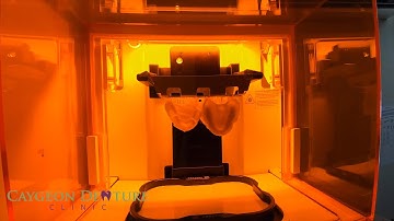 Printed Digital Try-In Dentures