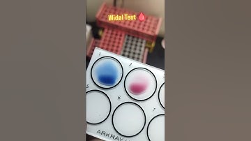 #labtechnician#bloodtest #bmlt_lecture #lablife #pathology #lab #motivation#shorts #science#ytshorts