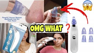I didn't Expect that... NEW Pore + Blackhead SUCKING Vacuum!
