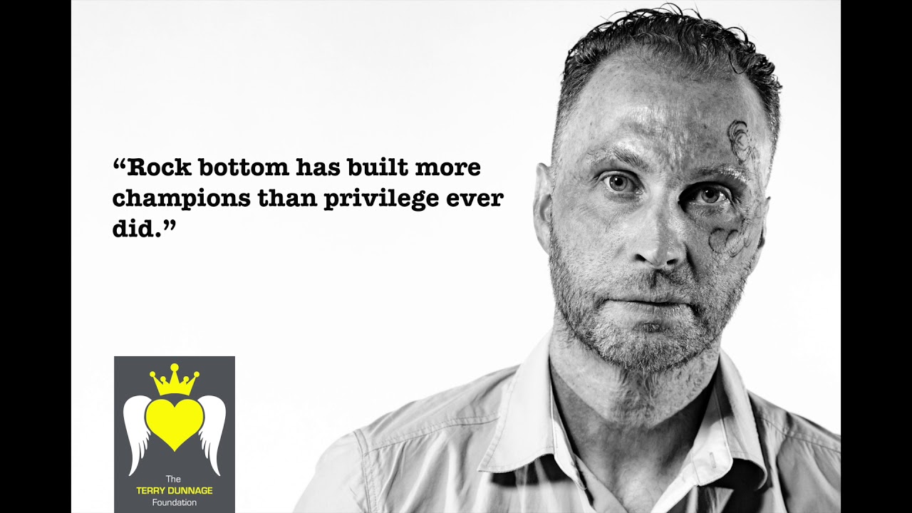 Burns Survivors photograph campaign by Riyat Media - Terry Dunnage Foundation