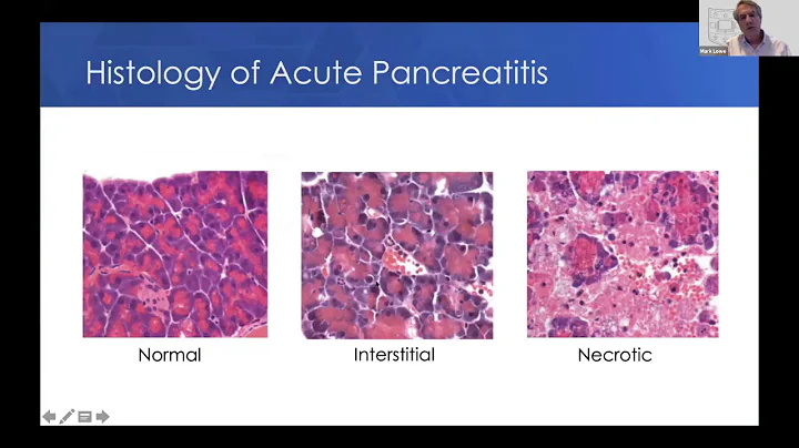 Pediatric Pancreatic Disorders by Mark Lowe, MD, PhD -  CAPER Pancreas Academy 2020