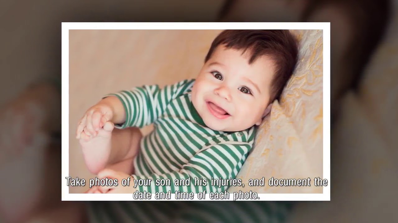 When is a Botched Circumcision Medical Malpractice? Curi Chan YouTube