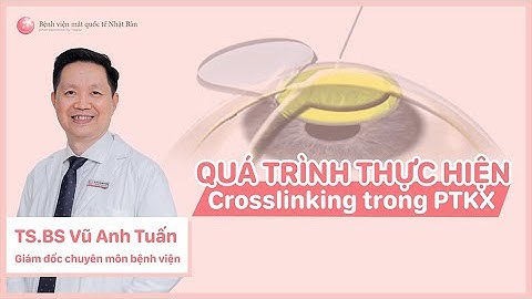 Quá trình thực hiện thủ thuật Crosslinking kết hợp với phẫu thuật khúc xạ bằng laser