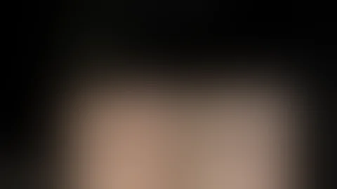 An approach to upper lid blepharoplasty