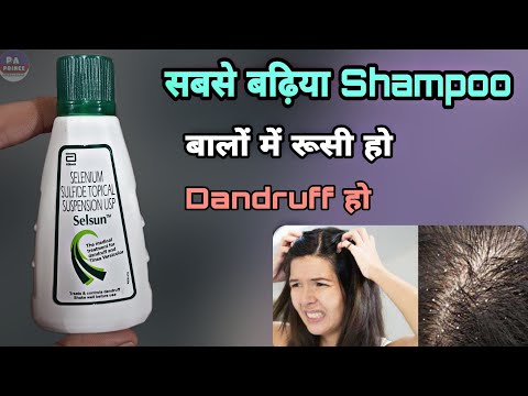 selsun shampoo | रूसी हो, dandruff हो | selsun shampoo for dandruff | Prince Azeemuddin