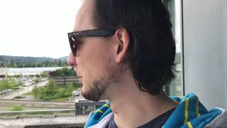 New Eye Reveal: SmartSurfACE PRK at Pacific Laser Eye Centre, Day 5 post-surgery