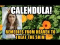 Calendula - Natural Remedy Given To Treat The Skin - Revealed To Luz de Maria Concerning Times Ahead