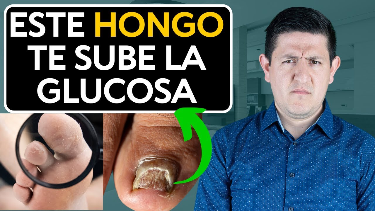 Como eliminar CANDIDA definitivamente PASO a PASO Dr. Antonio Cota Sugar Care