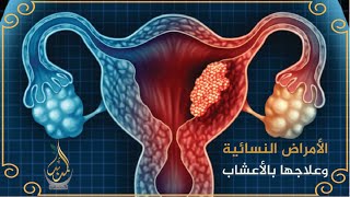 الصمغ العربي وفوائدة في علاج الأمراض المناعية وأمراض العصر والنزوف النسائيه