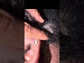 Beard Dandruff Scratching