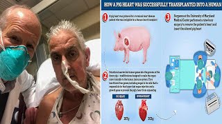 &#39;Xenotransplantation&#39; World First &#39;Pig Heart&#39; Succesfully Transplanted Into Human