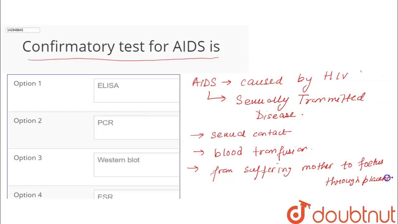 Confirmatory test for AIDS is YouTube