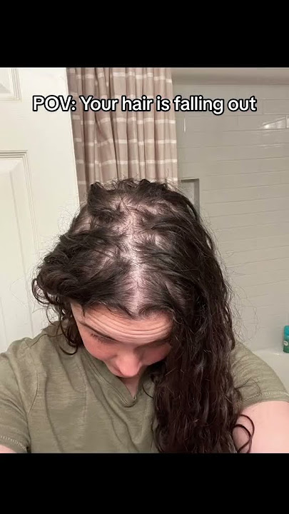 Are you experiencing HAIR LOSS?!! #hair #hairloss