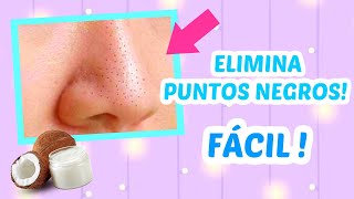 Nariz sin puntos negros ! Descubre como eliminarlos con Aceite de cOCO