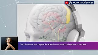 Open Mics with Dr. Stites - Treating Tinnitus